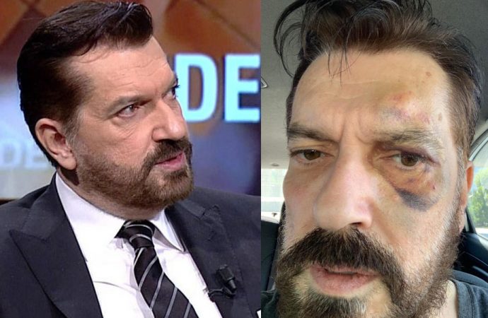 SONAR Araştırma şirketinin sahibi Hakan Bayrakçı’ya saldırı