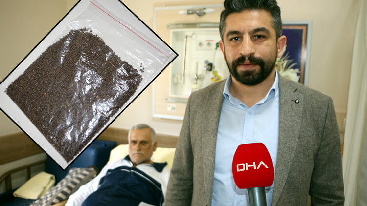 Safra kesesinden binlerce taş aldırdı; Guiness'e başvurdu