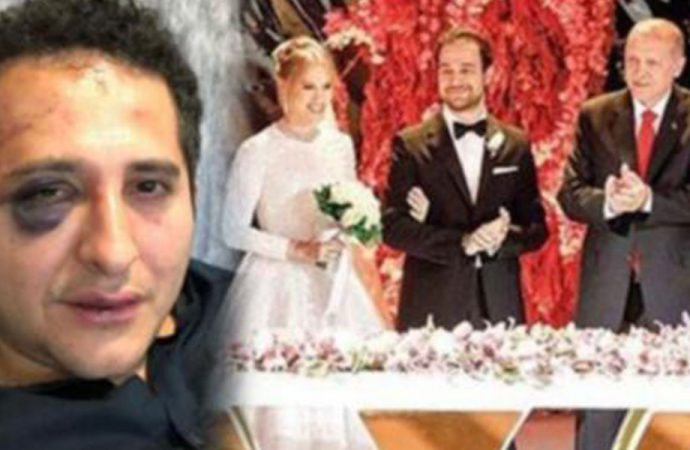 İstanbul Valisi Ali Yerlikaya, korumaların yaptığı işkenceyi savundu…