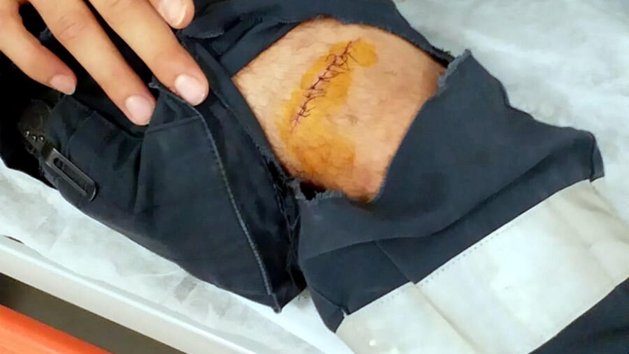 Hastanede makasla sağlık çalışanını yaraladı
