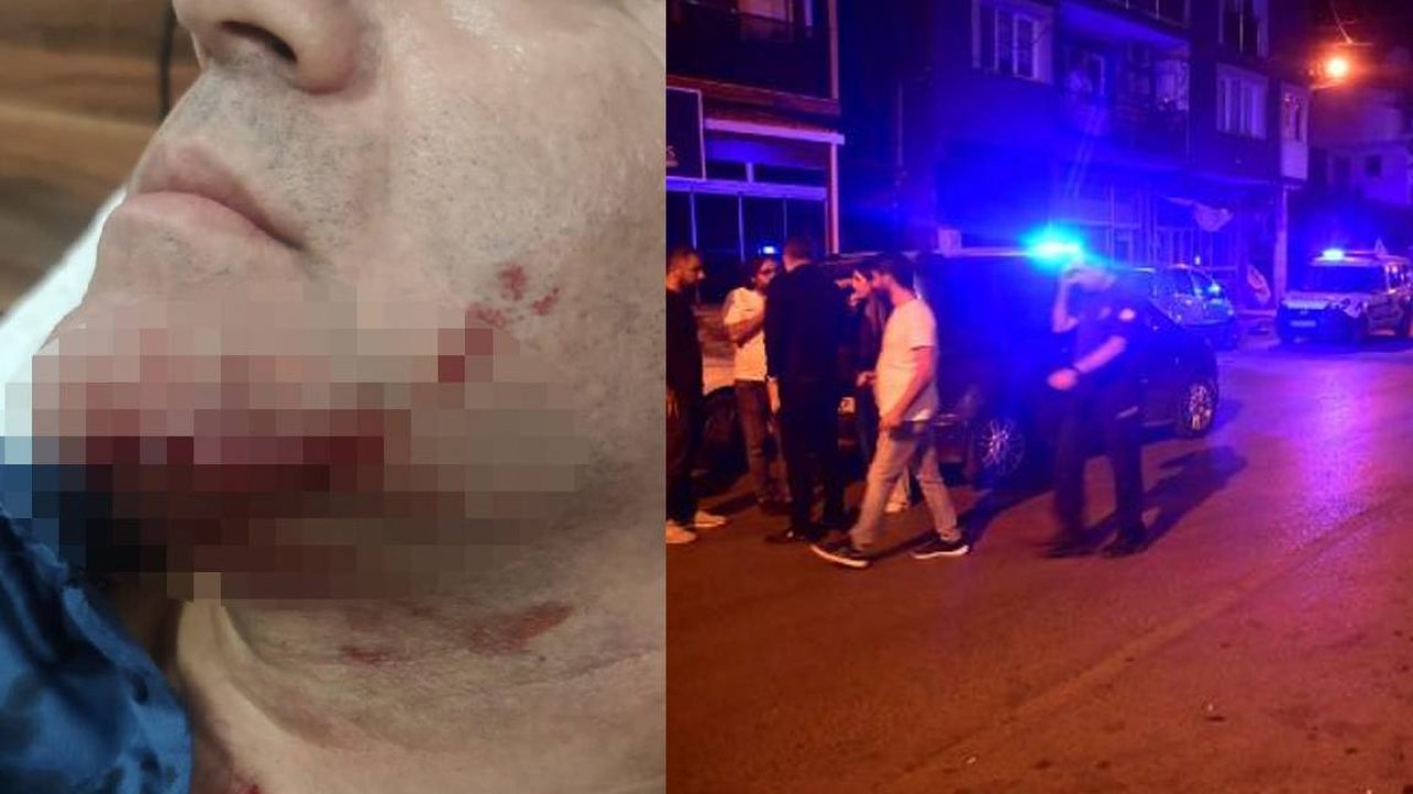 Polisi bıçakla yüzünden yaralamıştı: Saldırgan serbest bırakıldı