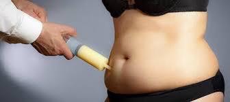 Liposuction Estetiği Yöntemleri