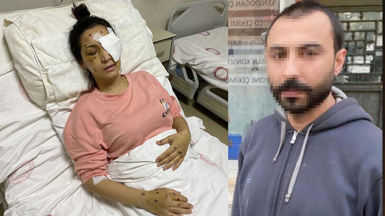 Yengesini 37 yerinden bıçaklayıp bir gözünü kör etti: Sanığa 15 yıl hapis cezası