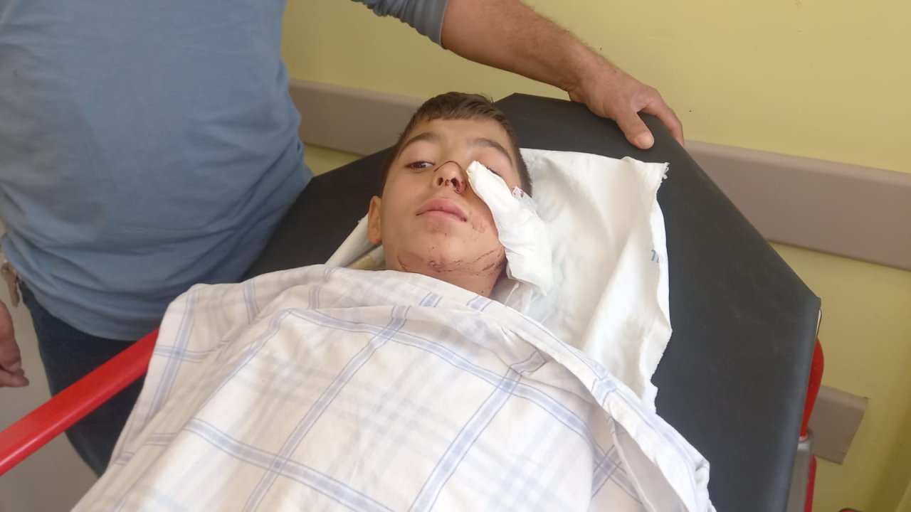 Sokak köpekleri saldırdı: 12 yaşındaki Umut, ağır yaralandı
