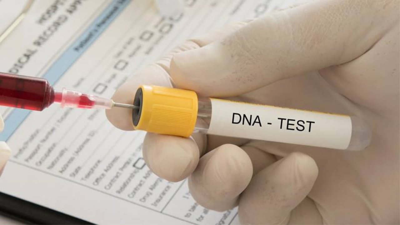 Türkiye'de bir ilk: DNA testiyle gelen 186 milyon liralık miras