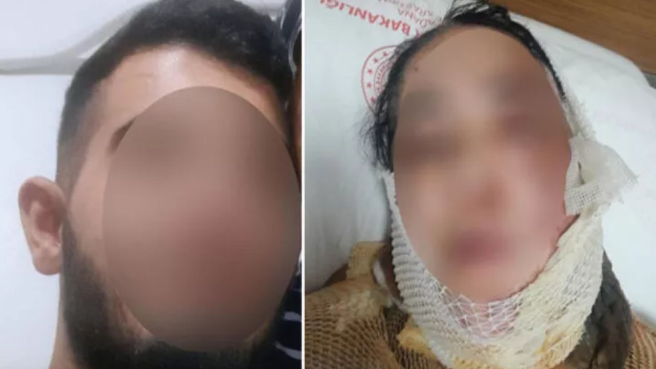 Üvey annesinin yüzüne kezzap döktü!
