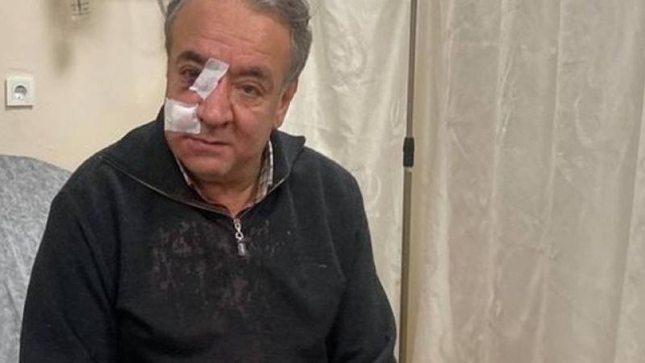 Doktora yumruklu saldırı: ''Seni parçalarım'' diyerek tehdit etti