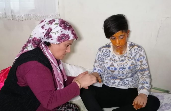 Arkadaşını üzerine benzin döküp yaktı!