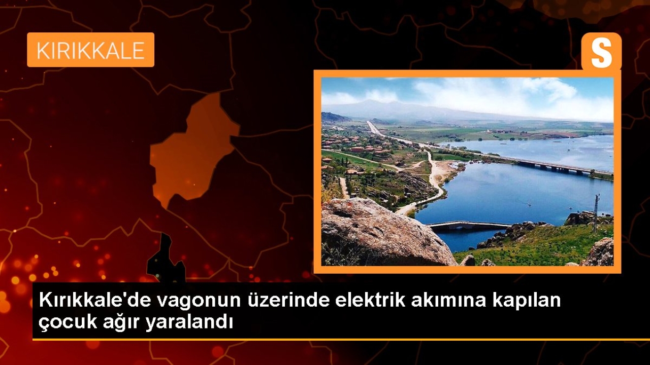 Kırıkkale'de Vagonun Üzerine Çıkan Çocuk Yüksek Gerilim Hattına Kapıldı