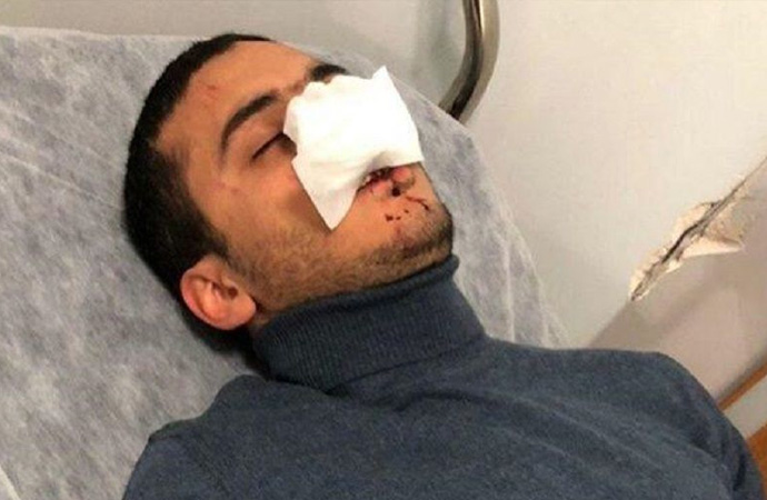 Türk dizilerinde oynayan Mısırlı oyuncuyu ‘Suriyeli’ sandı, öldüresiye dövdü!
