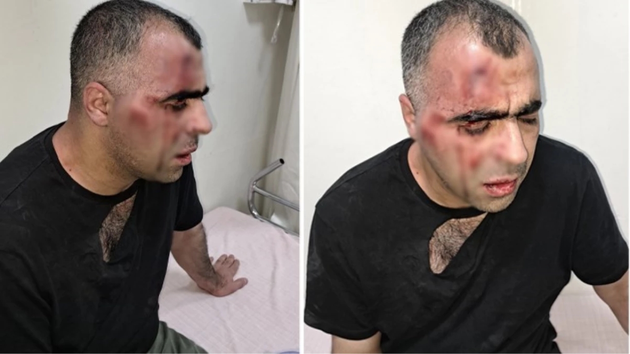 Gazeteci Sinan Aygül'ün darp edilmesi sonrası soruşturma açıldı: Polis memuru açığa alındı