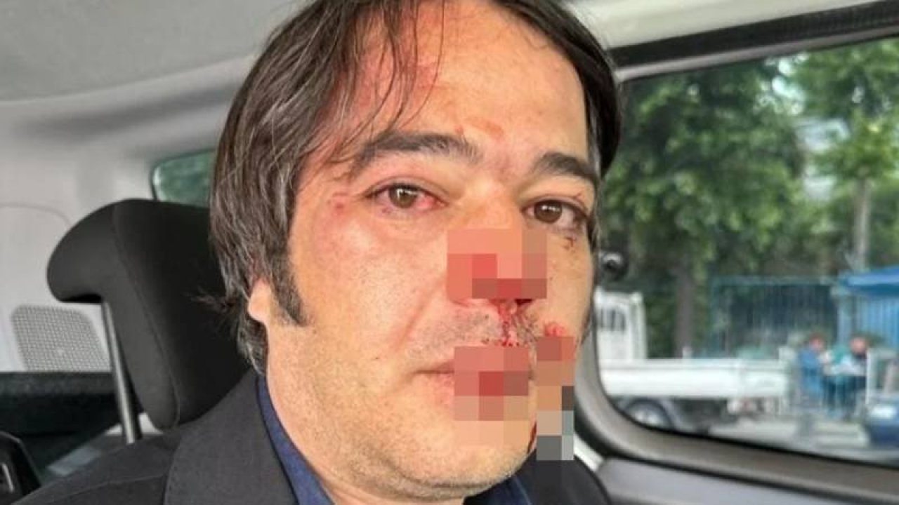 İBB İmar Müdürü Ramazan Gülten'e saldıran sanık hakkında 10 yıl 9 aya kadar hapis talebi