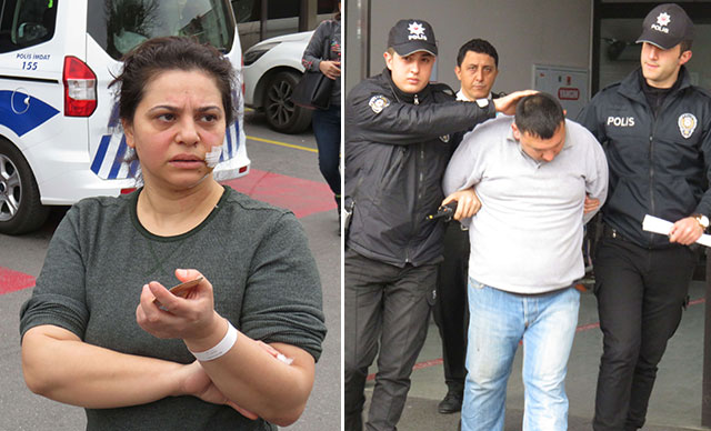 Boşanma davası açan eşini öldürmeye çalıştı