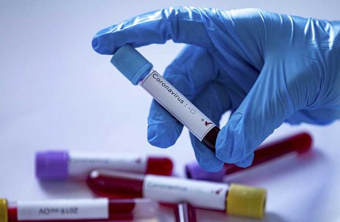 Özel sağlık sigortası koronavirüs tedavisini kapsıyor mu?