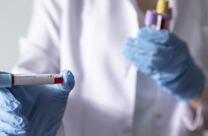 Fransa’dan, ‘koronavirüs ilacı’ açıklaması: Bu virüs ile başa çıkabilmek…