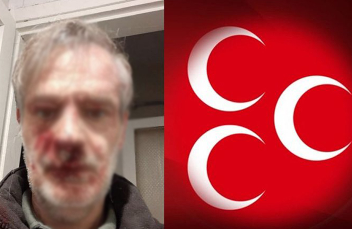 MHP Grup Başkanvekili Erkan Akçay’dan skandal ‘dayak’ paylaşımı