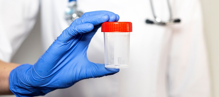 Sperm testi nedir?