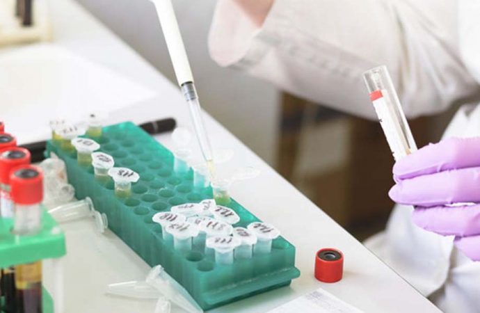 Oxford’lu bilim insanları, 20 dakikada sonuç verecek test geliştirdi