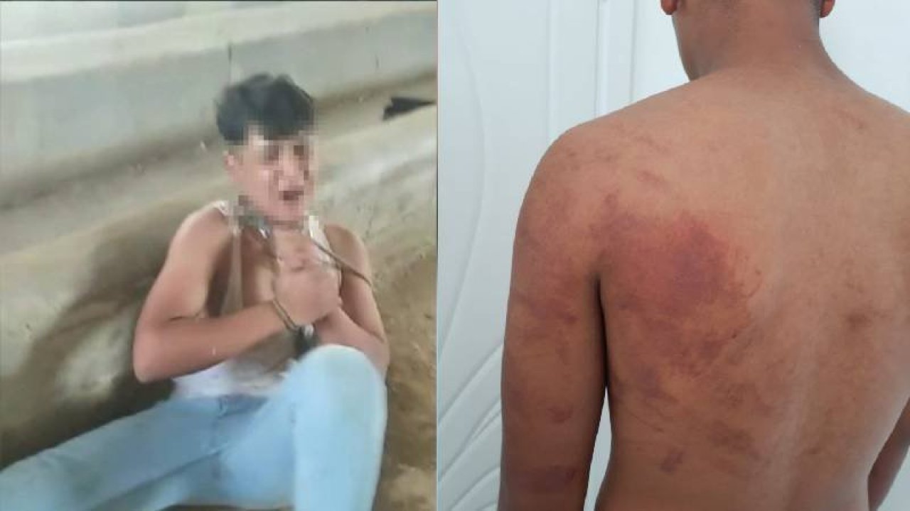 Ahırda zincirli işkence iddiası: Baba, amca ve ağabeye gözaltı