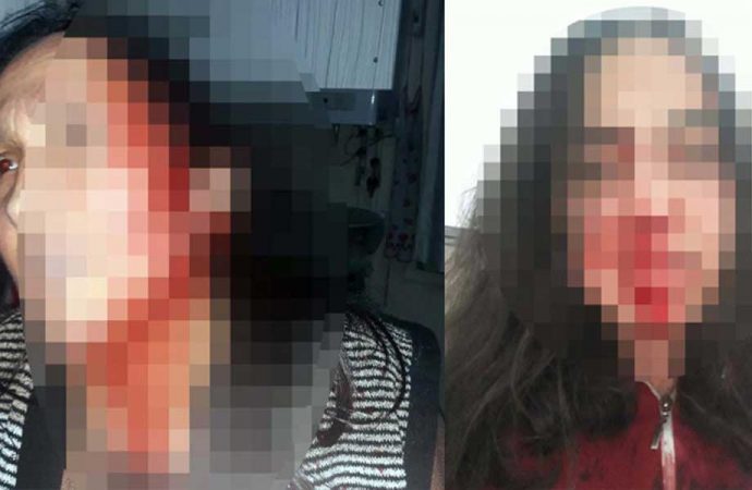 Annesi ve kız kardeşini öldüresiye döven cani serbest bırakıldı