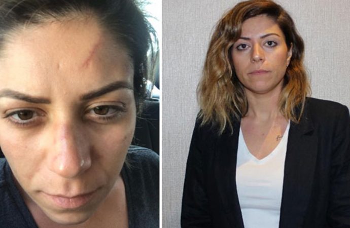 Boşandığı eşinden şiddet gören avukat: Kafama poşet geçirip, boğazıma bıçak dayadı