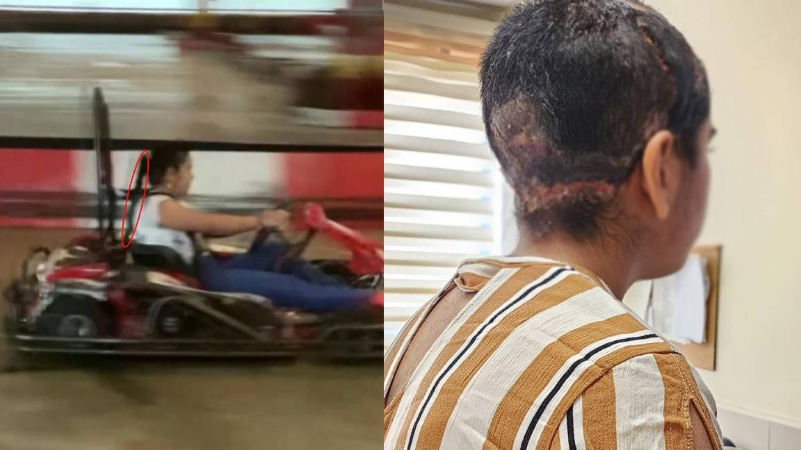 Go-kart'ta büyük ihmal: Kask verilmeyen Lara ölümden döndü