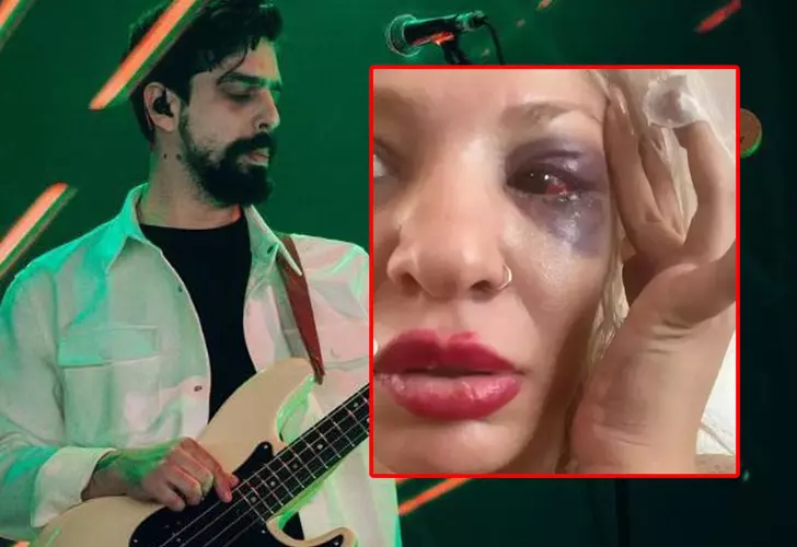 Yüzyüzeyken Konuşuruz'un gitaristi Can Tunaboylu sevgilisini darp ettiği iddialarıyla gündemde: SORUŞTURMA AÇI