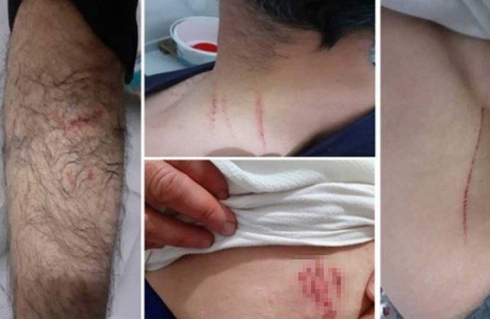Diyarbakır Valiliği’nden köpekle işkence iddialarına yanıt: Kasıtlı değil