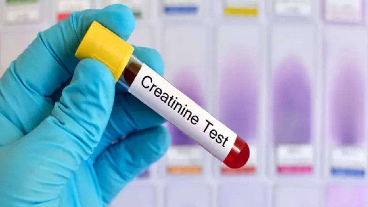 Kreatinin Nedir: İşlevi, Testleri ve Sağlık Üzerindeki Etkileri