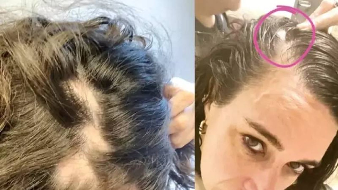 İş insanı Yasemin Sadıkoğlu gece kulübünde saldırı: Saçları Koparıldı