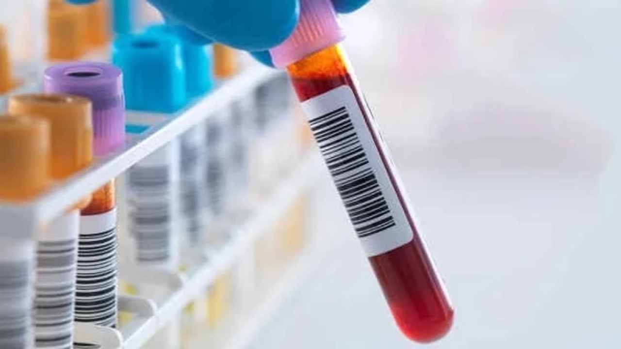 Acth testi nedir?