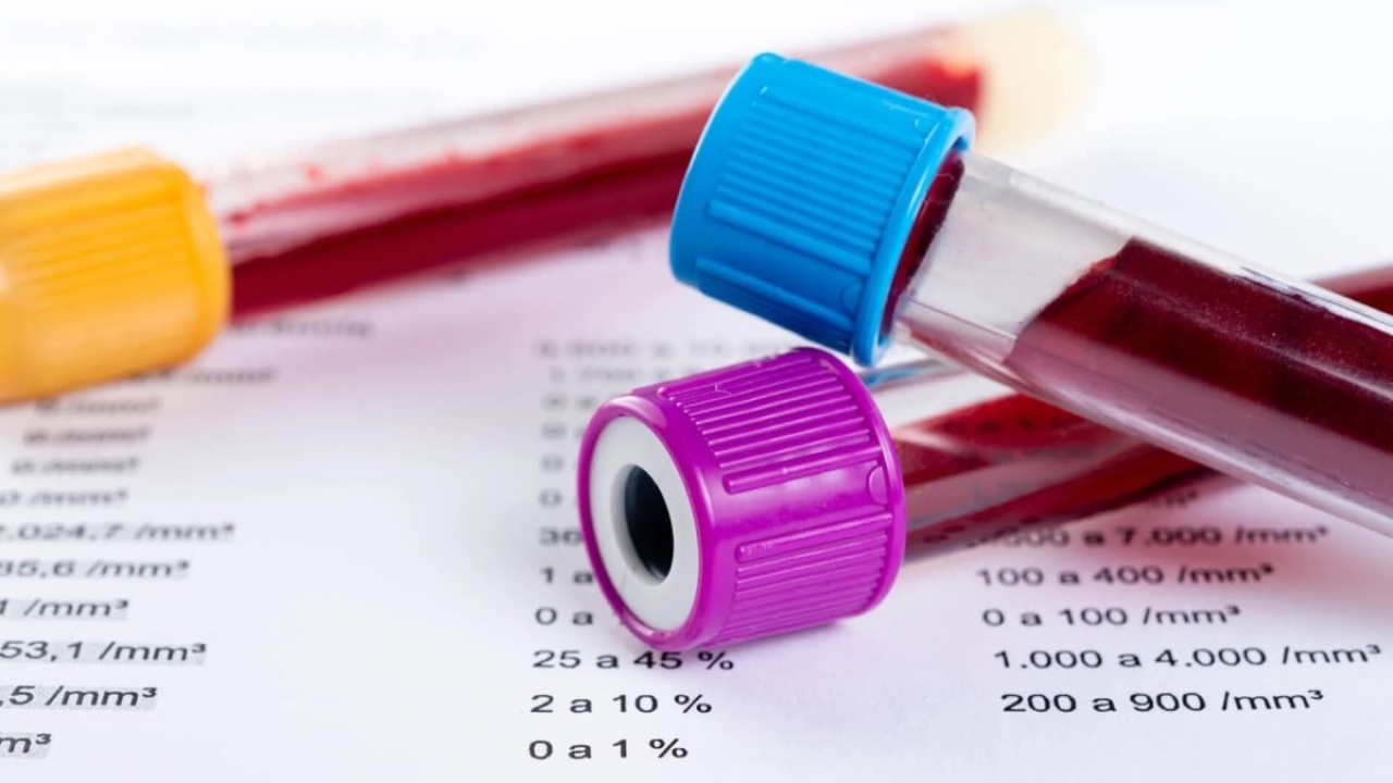 Albumin testi nedir