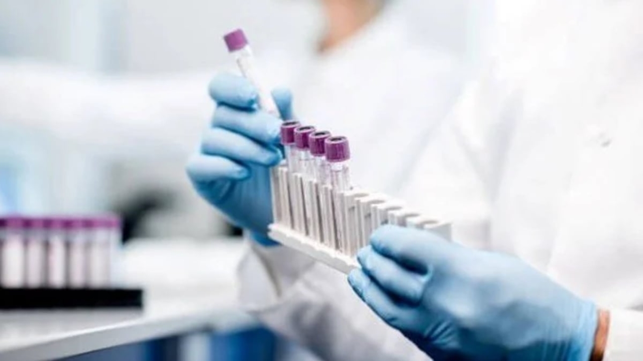 Amilaz testi nedir?
