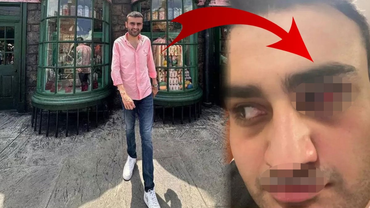Gözü kan çanağına dönen CZN Burak korkuttu! Paylaşımına öyle bir not yazdı ki herkes şaştı kaldı
