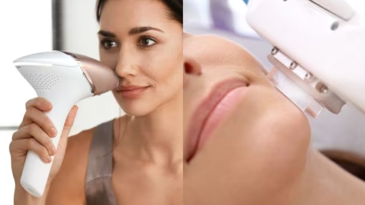 Epilasyon yaptıracaklar için Ipl cihazı ne işe yarar?