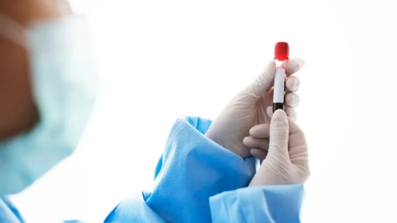 Fsh testi nedir?