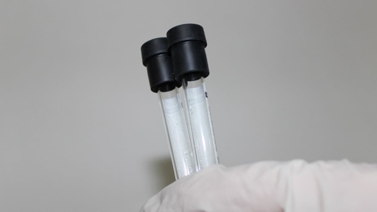 Homosistein testi nedir?