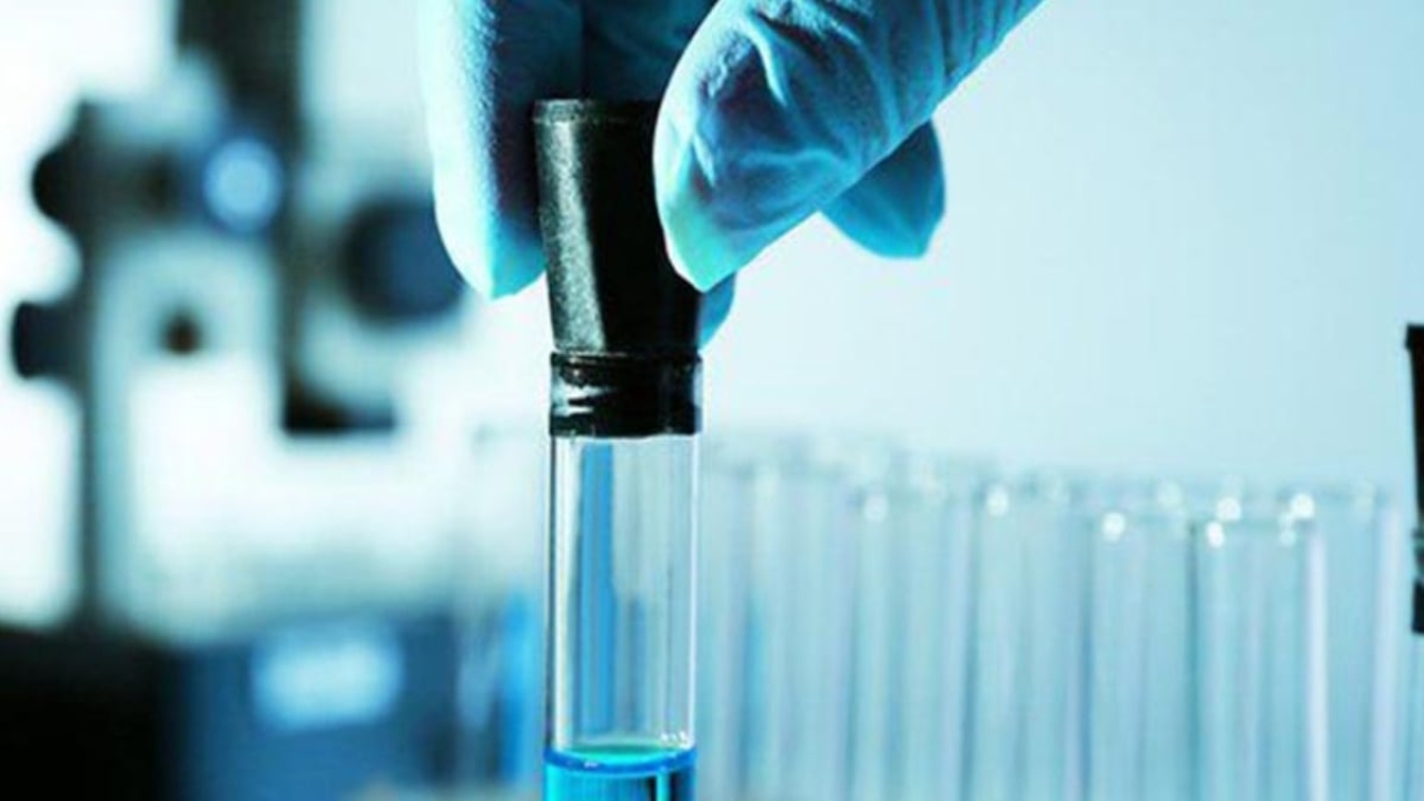 LDH testi nedir?