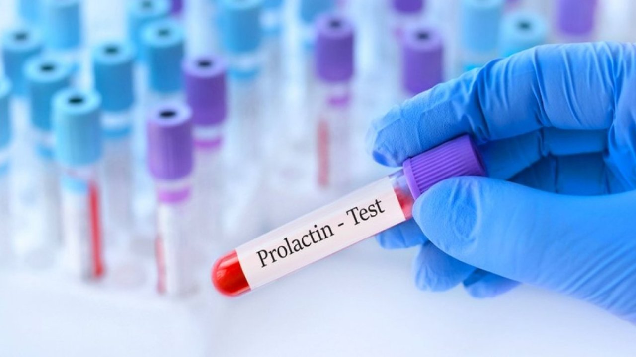 Prolaktin Hormonu Nedir?