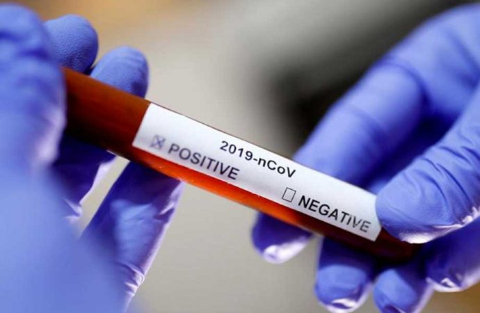 10 sağlık çalışanının koronavirüs testi pozitif çıktı