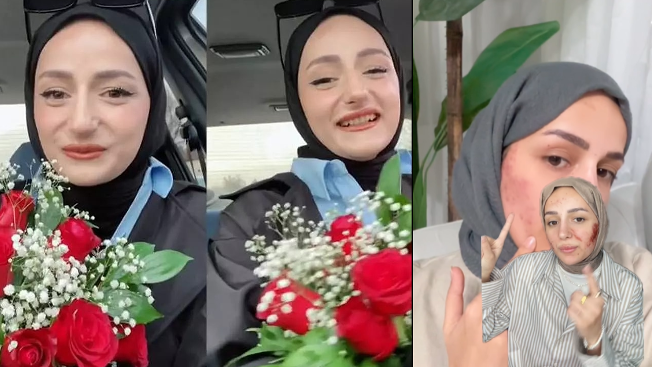 Fenomen Gizem Yıldız: Estetik İşlemlerim Korkunç Değil!