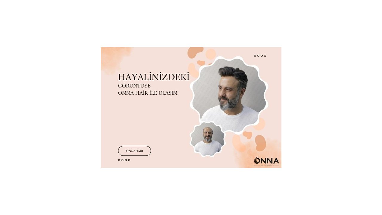 Hayalinizdeki Görüntüye Onna Hair Protez Saç ile Ulaşın!