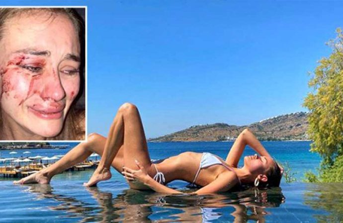 Ukraynalı modele darp olayında flaş gelişme