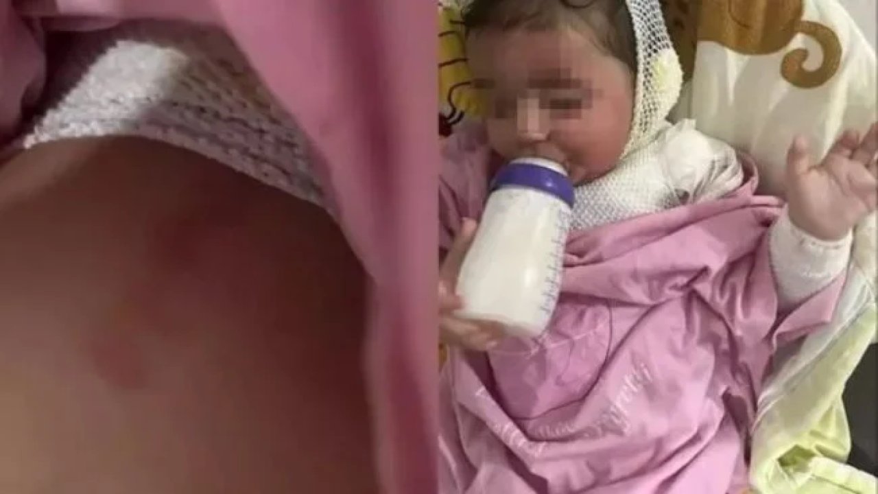 Kreşte korkunç olay: Bebek kaynar kahve ile resmen haşlandı!