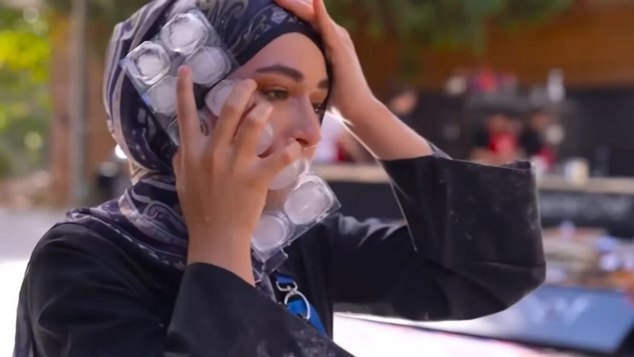 MasterChef'te Yüzü Yanan Beyza Yarışmaya Dönecek mi? Somer Şef Açıkladı