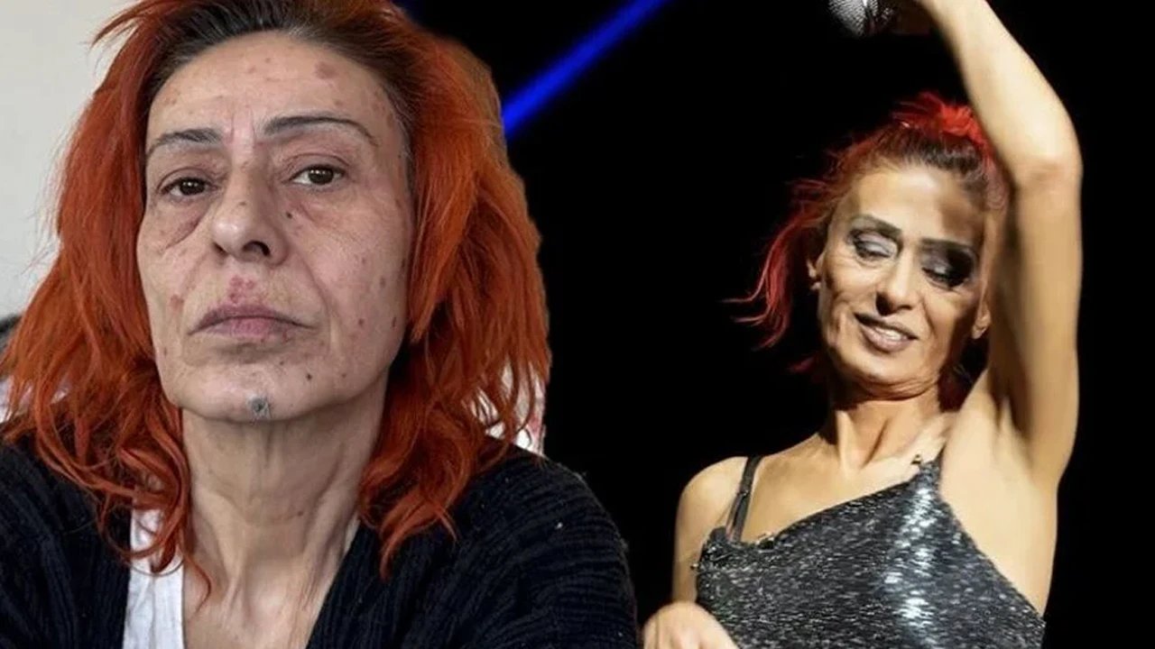 Yıldız Tilbe'nin yüzünde yanıklar oluşmuştu; Olayın perde arkasını anlattı