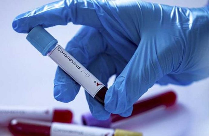 Tekstil fabrikasında koronavirüs alarmı! Fabrikada üretim durdu
