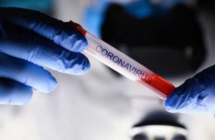 Koronavirüs testleriyle ilgili flaş iddia: Testler 'ayrıcalıklı gruplar'a mı yapılıyor?
