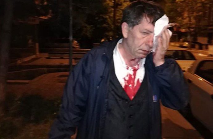 Saldırının ardından gazeteci Yavuz Selim Demirağ’dan ilk yazı: ‘Korkmuyorum’