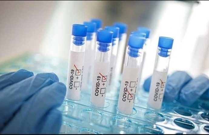 İhaleler AK Partililere: Kovid-19 testi satın alınan şirket yasaklı çıktı!
